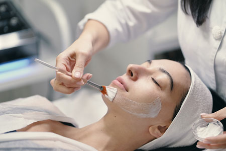 chemical-peels-image
