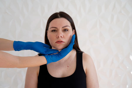 dermal-fillers-for-jawline-image
